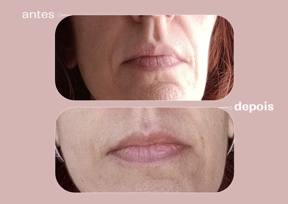 Kit Regenera Noite: Retinol, PDRN e Baobá DNA De La Terre Cosmeticos