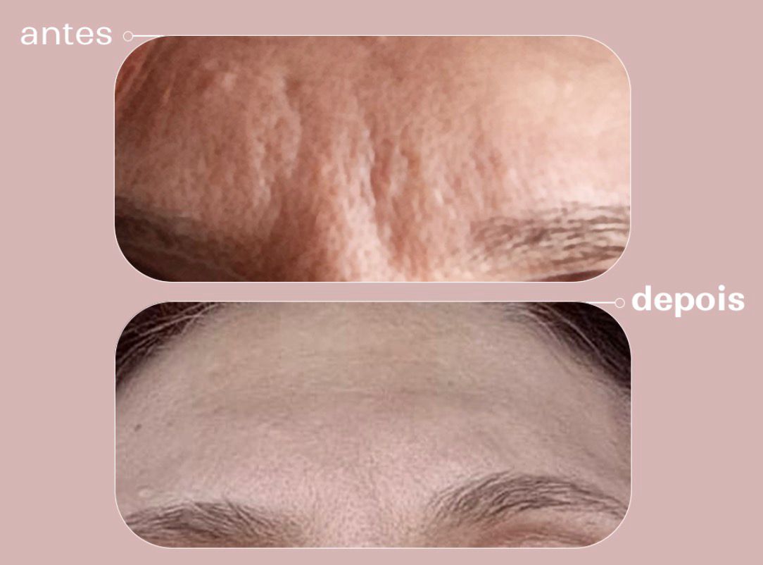 Kit Regenera Noite: Retinol, PDRN e Baobá DNA De La Terre Cosmeticos