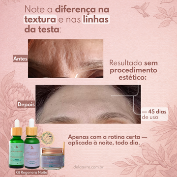 Kit Regenera Noite: Retinol, PDRN e Baobá DNA